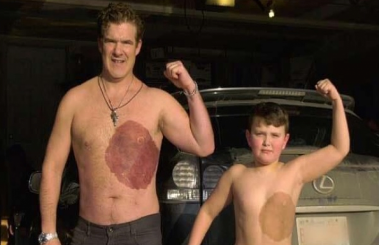 Pai tatua no seu corpo marca de nascença do Filho